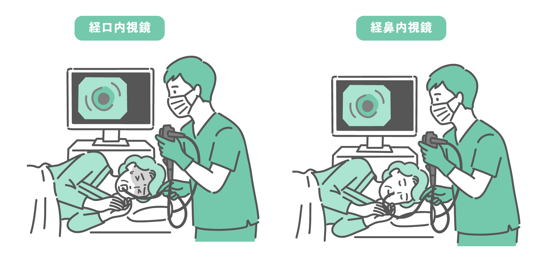 左側は経口内視鏡（口から）で嘔吐反射に苦しむ高齢女性、右側は経鼻内視鏡（鼻から）でリラックスして検査を受ける高齢女性を描いた、胃カメラの検査方法比較イラスト。文字入り。