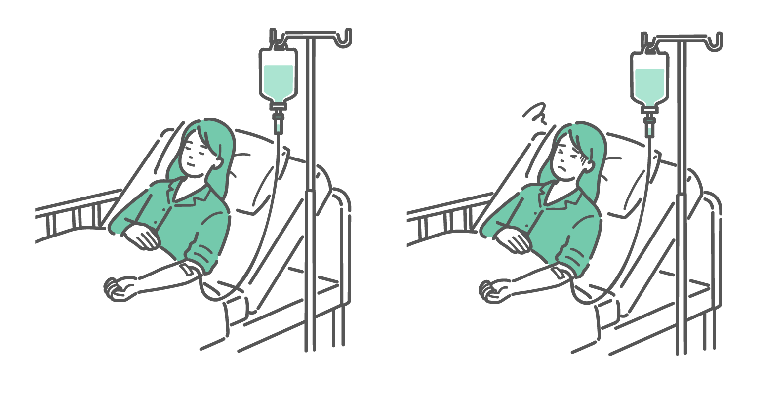点滴を受ける女性患者の安静時と気分不快時の表情比較イラスト