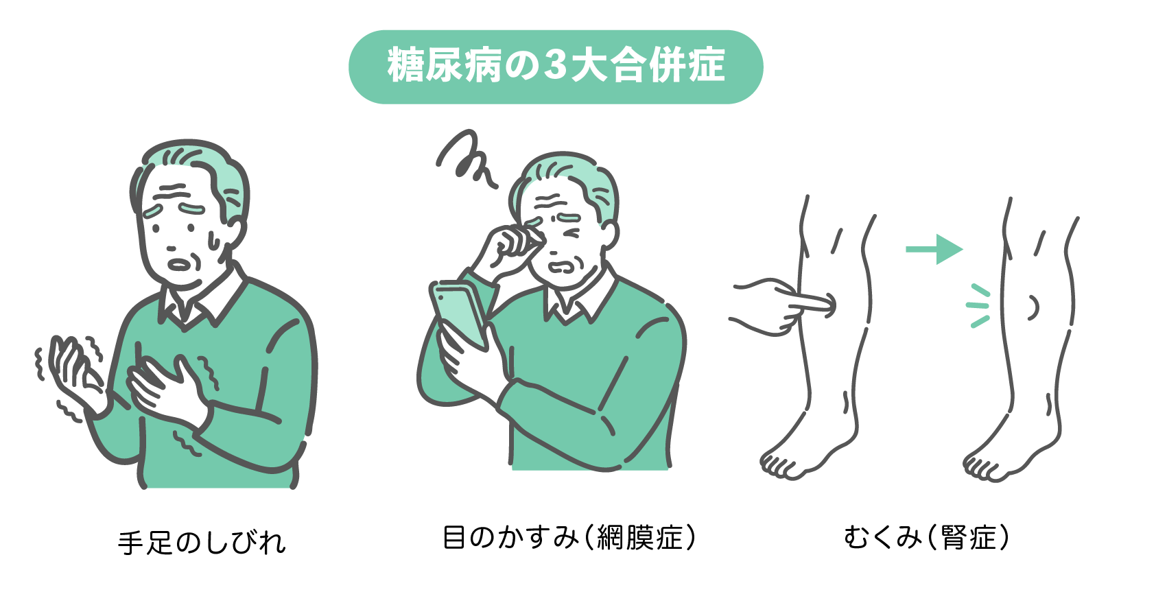 糖尿病の3大合併症セット（高齢男性版）。手足のしびれを気にするおじいさん、スマホを見て目のかすみを感じるおじいさん、足のむくみを確認する図解の3点