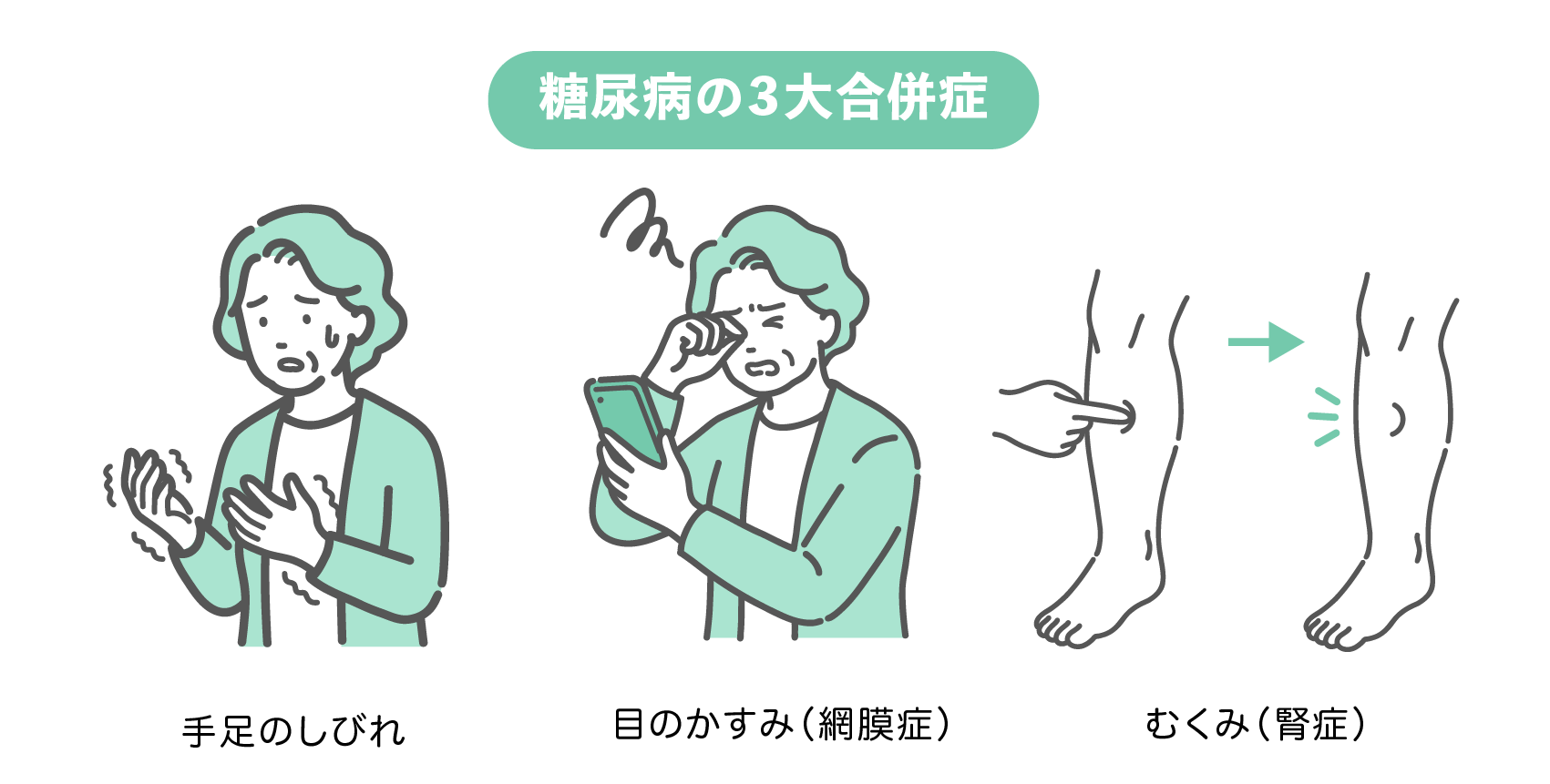 糖尿病の3大合併症セット（高齢女性版）。手足のしびれに困っているおばあさん、スマホを見て目のかすみを感じるおばあさん、足のむくみを確認する図解の3点