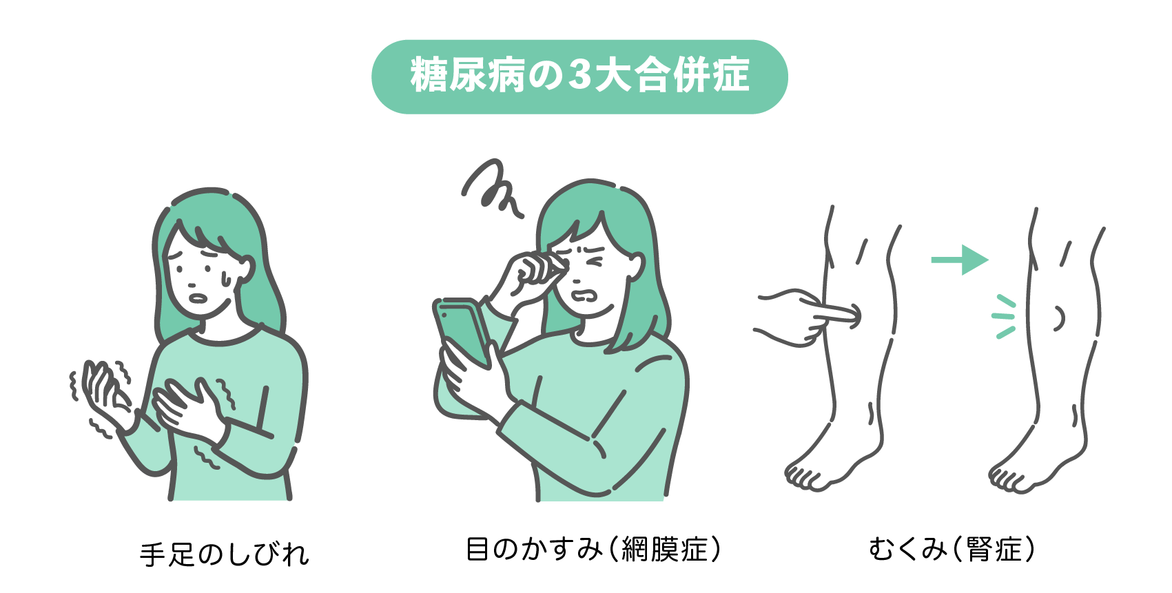 糖尿病の3大合併症セット（女性版）。手足のしびれに不安そうな女性、スマホを見て目のかすみを感じる女性、足のむくみを確認する図解の3点