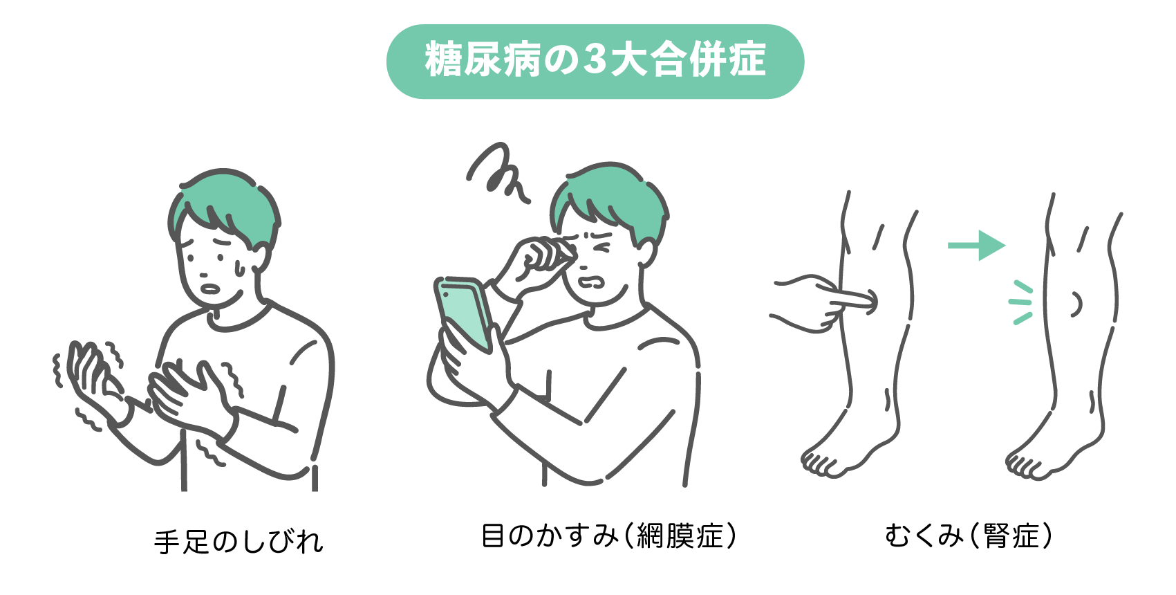 糖尿病の3大合併症を描いたイラストセット。手足のしびれに悩む男性、スマホを見て目のかすみを感じる男性、足のむくみ（圧痕）を確認する図解の3点