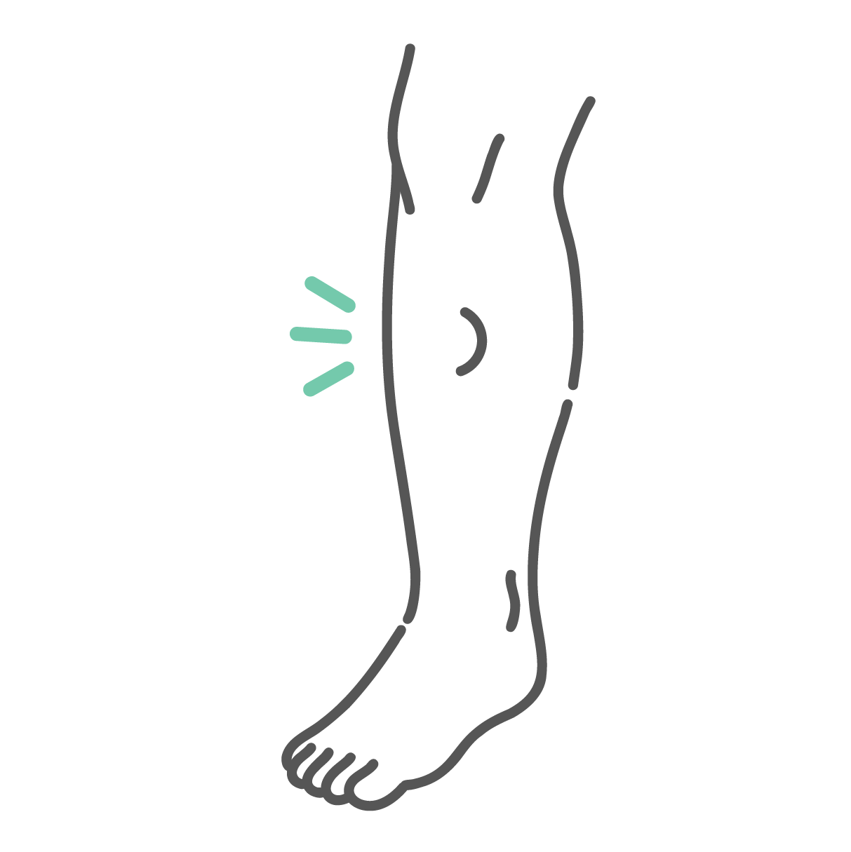 足のすねの部分に指で押したようなくっきりとしたへこみ（圧痕）が残っている、重度のむくみのイラスト